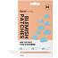 Face Facts Blemish Patches - Clouds (9958) (39941-150) - FF.B/31